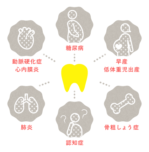 糖尿病、早産低体重児出産、骨粗しょう症、認知症、肺炎、動脈硬化症心内膜炎