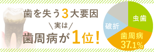 くすりで治す歯周内科治療