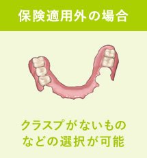 保険適用外の場合：クラスプがないものなどの選択が可能